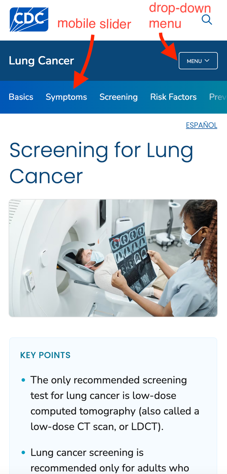 screening lung cancer nav display